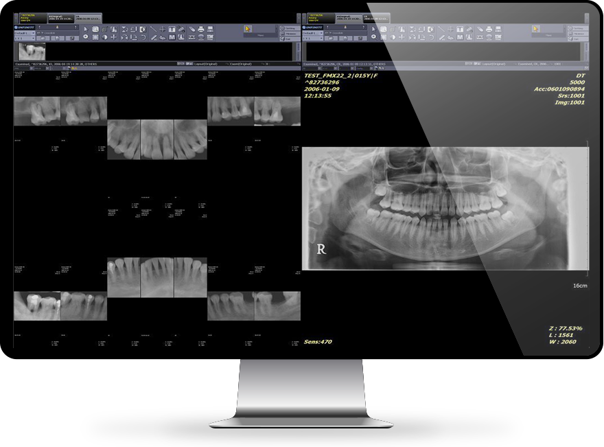 Dental Imaging Solutions INFINITT North America
